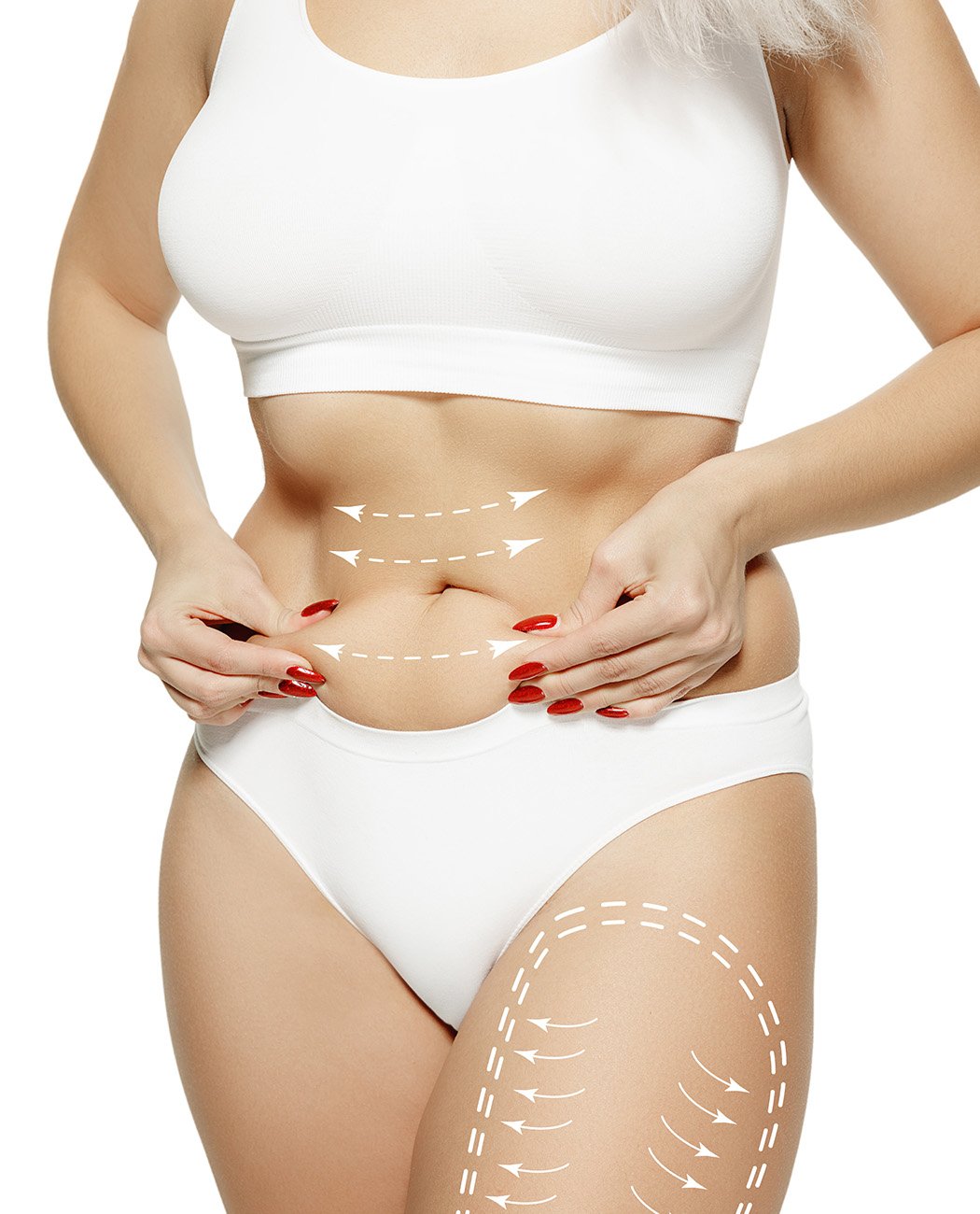 Who is an Ideal Candidate for Mommy Makeover Surgery?