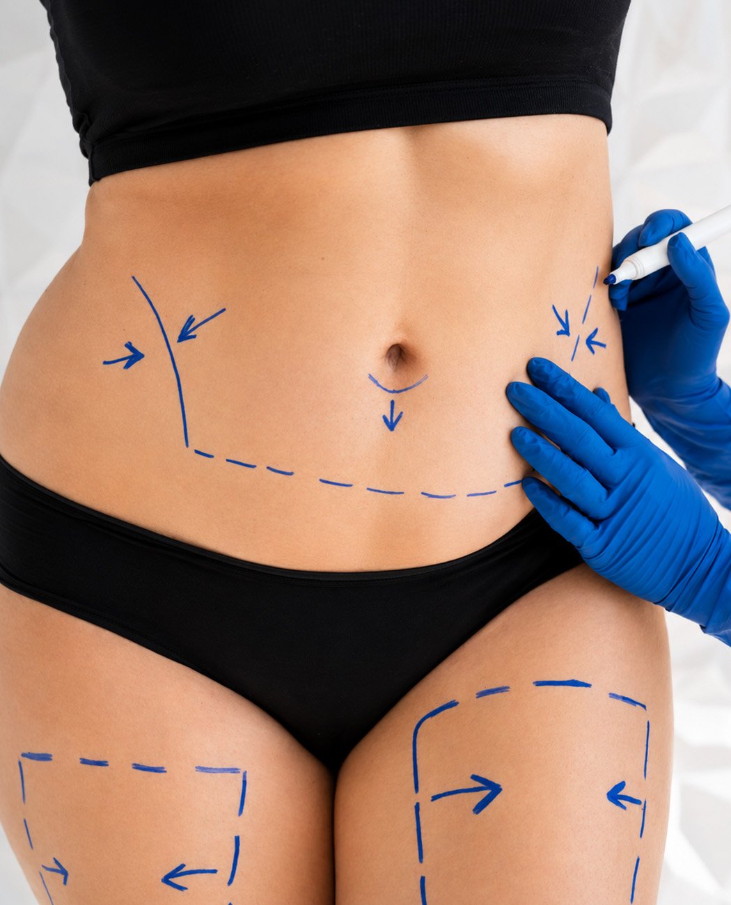 How is Fat Dissolving Injections Treatment Performed?
