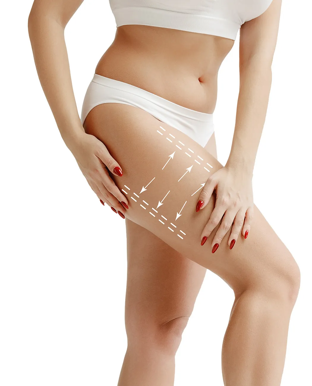 What is Thigh Lift Surgery?