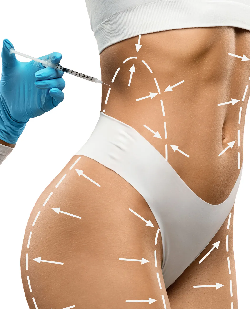 What are Fat Dissolving Injections?