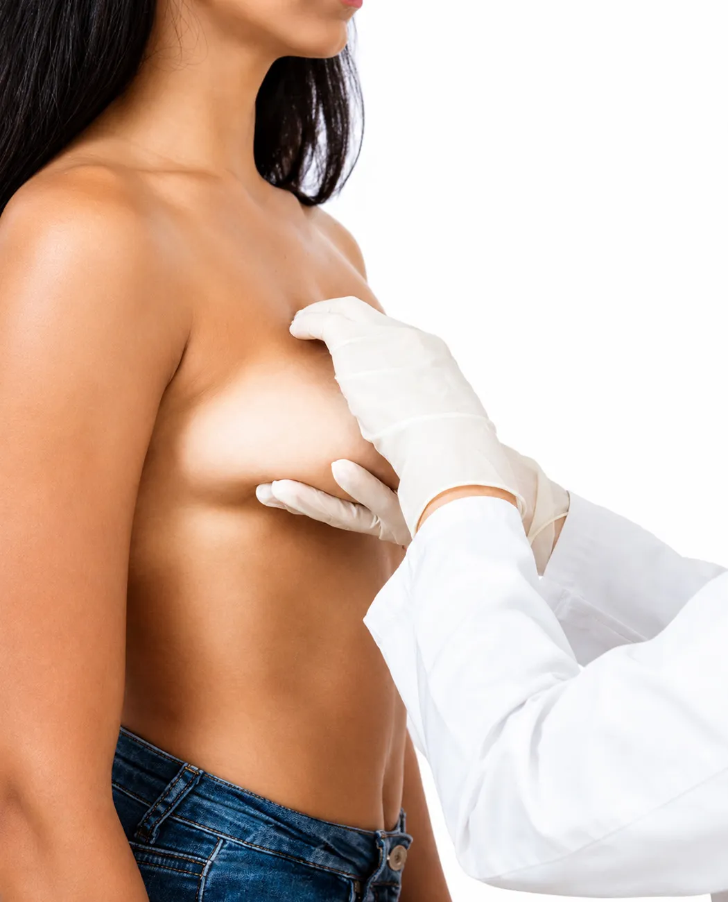 How is Breast Lift Surgery Performed?