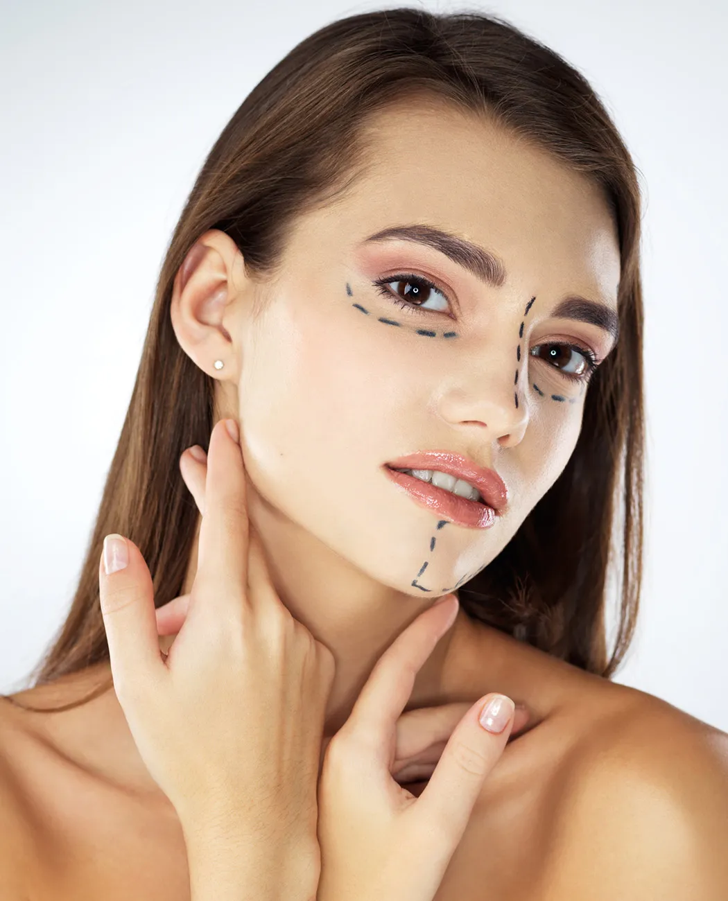 What is Facelift Surgery?