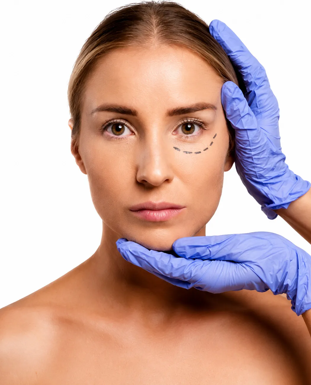 Who is an Ideal Candidate for Blepharoplasty surgery?