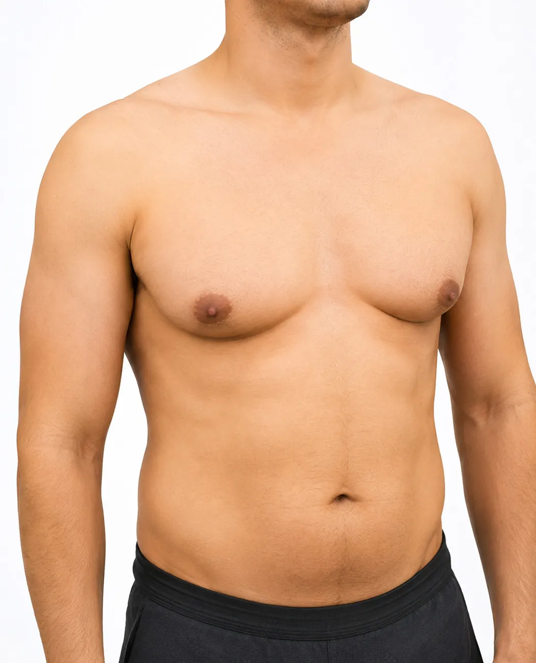 How is Gynecomastia Surgery Performed?