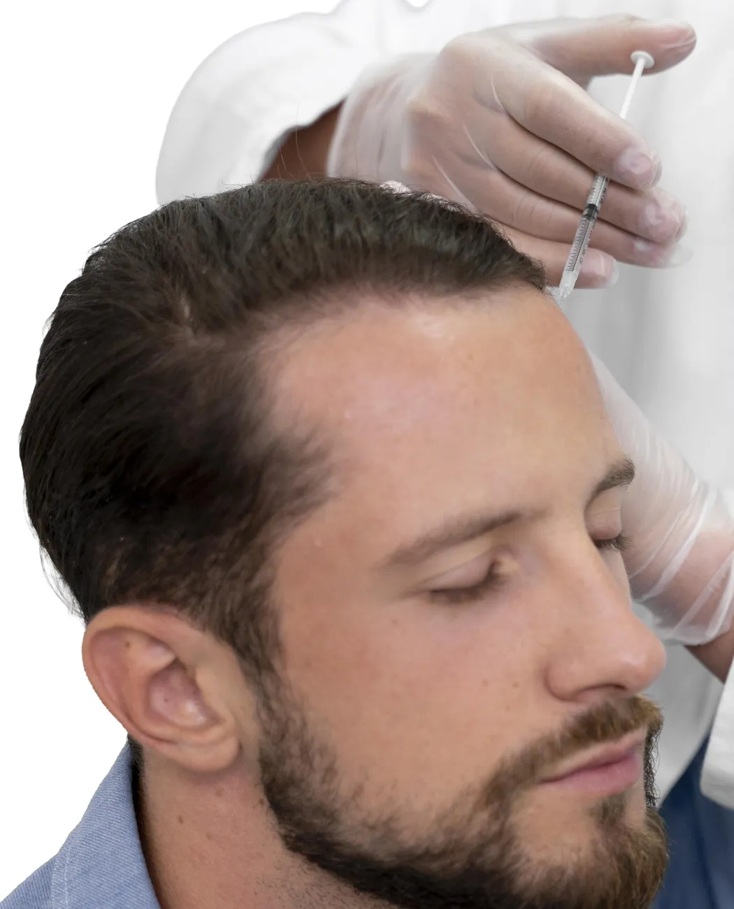 How is Hair Transplant (FUE/FUT) Surgery Performed?